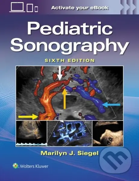 Pediatric Sonography (Sixth Edition) - MARILYN JOY SIEGEL