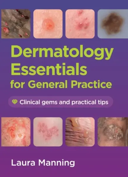 Dermatology Essentials for General Practice - Laura  Manning