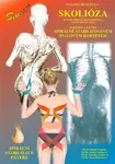 Svalové řetězce 4 - Spirální stabilizace páteře - Skolióza - Richard Smíšek, Kateřina Smíšková, Zuzana Smíšková, Alena Böhmerová