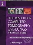 High Resolution Computed Tomography of the Lungs (A Practical Guide) - kniha z kategorie Medicína