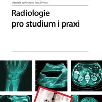 Radiologie pro studium i praxi - Zdeněk Seidl, Manuela Vaněčková, Andrea Burgetová, Eva Hoffmannová, Martin Mašek, Tomáš Viták - e-kniha