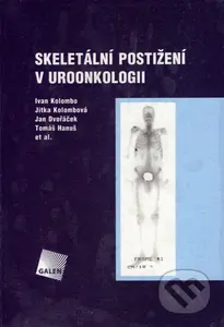 Skeletální postižení v uroonkologii - Ivan Kolombo, Jitka Kolombová, Jan Dvořáček, Tomáš Hanuš - kniha z kategorie Onkologie