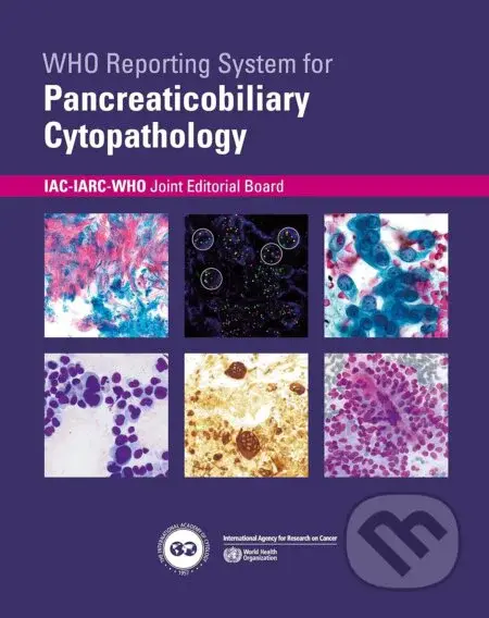 WHO reporting system for Pancreaticobiliary Cytopathology - kniha z kategorie Medicína