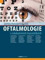 Oftalmologie v edukativních kazuistikách - Jarmila Heissigerová