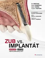 Zub vs. implantát - Bertani Pio, Generali Paolo, Gorni Fabio, Testori Tiziano