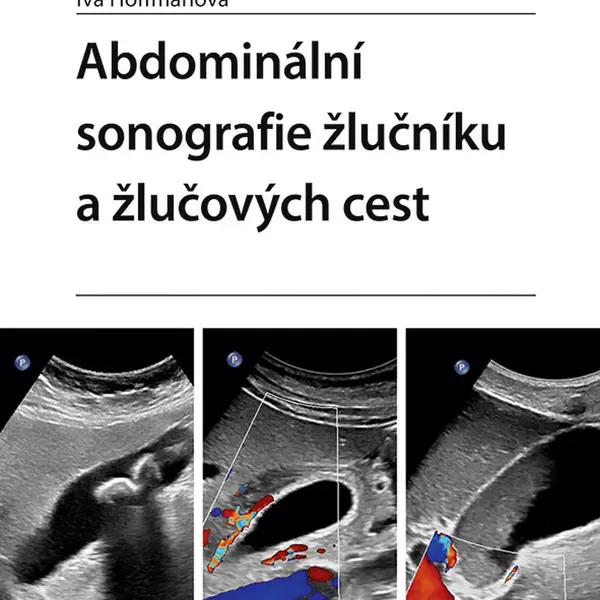 E-kniha: Abdominální sonografie žlučníku a žlučových cest od Hoffmanová Iva