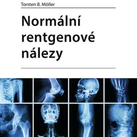 Kniha: Normální rentgenové nálezy od Möller Torsten B.