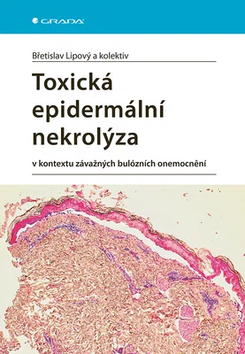 E-kniha: Toxická epidermální nekrolýza od Lipový Břetislav