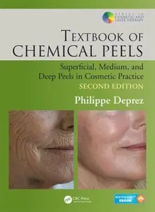 Textbook of Chemical Peels - Philippe  Deprez