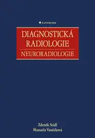 Diagnostická radiologie - Zdeněk Seidl, Manuela Vaněčková