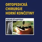 Ortopedická chirurgie horní končetiny
