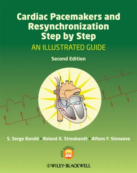 Cardiac Pacemakers and Resynchronization Step by Step - Alfons F. Sinnaeve, S. Serge  Barold, Roland X. Stroobandt