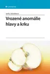 Vrozené anomálie hlavy a krku, Jakubíková Janka