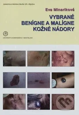 Vybrané benígne a malígne kožné nádory - Eva Mináriková - kniha z kategorie Učebnice a slovníky
