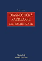 Diagnostická radiologie - Neuroradiologie - Zdeněk Seidl, Manuela Vaněčková