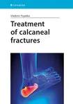 E-kniha: Treatment of calcaneal fractures od Popelka Vladimír