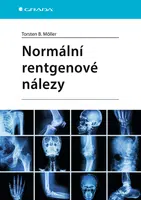 Kniha: Normální rentgenové nálezy od Möller Torsten B.