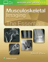 Musculoskeletal Imaging: The Essentials - Felix S. Chew