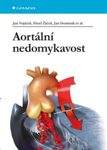 E-kniha: Aortální nedomykavost od Vojáček Jan