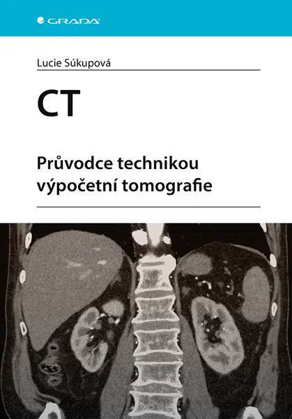 CT - Průvodce technikou výpočetní tomografie, Súkupová Lucie