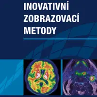 Inovativní zobrazovací metody - Jiří Ferda - e-kniha