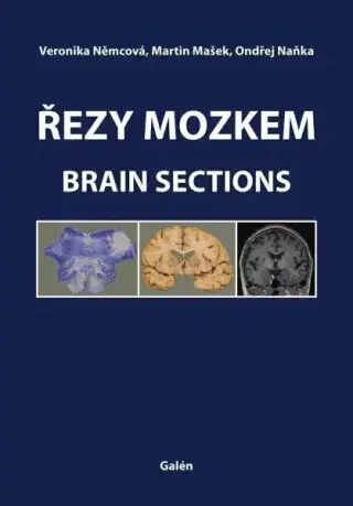 Řezy mozkem / Brain Sections - Ondřej Naňka, Martin Mašek, Veronika Němcová