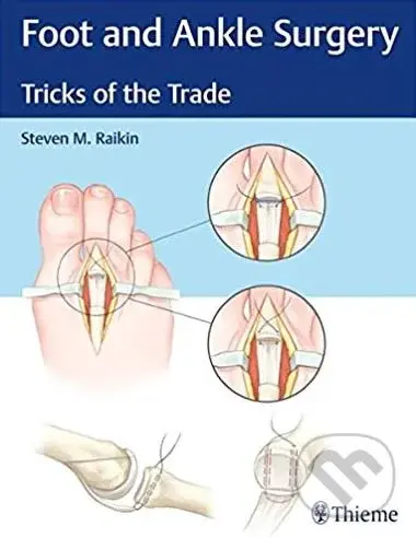 Foot and Ankle Surgery - Steven Raikin