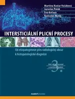 Intersticiální plicní procesy (Defekt)