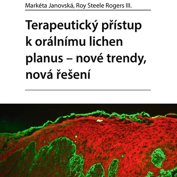Kniha: Terapeutický přístup k orálnímu lichen planus - nové trendy, nová řešení od Janovská Markéta