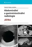 Abdominální a gastrointestinální radiologie - Vlastimil Válek, kolektiv autorů