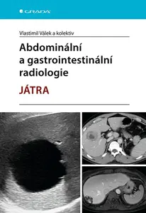 Abdominální a gastrointestinální radiologie - Vlastimil Válek, kolektiv autorů