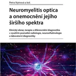 Neuromyelitis optica a onemocnění jejího širšího spektra - Petra Nytrová - e-kniha