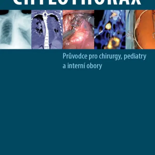 Chylothorax - kolektiv autorů, Szkorupa Marek