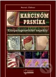 Karcinóm prsníka (Etiopatogenetické aspekty) - Pavol Žúbor - kniha z kategorie Gynekologie
