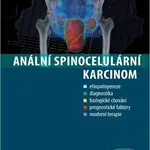 Anální spinocelulární karcinom - Radka Lohynská, - kniha z kategorie Medicína