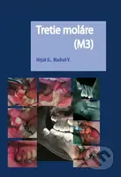 Tretie moláre (M3) - Dušan Hirjak, Vladimír Machoň - kniha z kategorie Stomatologie a dentální hygiena
