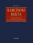 Karcinom rekta - Peter Ihnát
