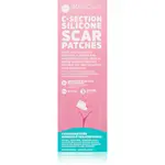 MomCare by Lina C-Section Silicone Scar Patches silikonové náplasti na jizvy po císařském řezu velikost L-XL 5 x 20 cm 3 ks