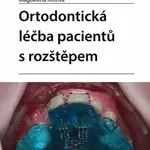 Ortodontická léčba pacientů s rozštěpem - Magdalena Koťová