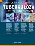 Tuberkulóza ve faktech i obrazech - Martina Vašáková, kolektiv autorů, Solovič Ivan