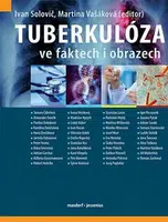 Tuberkulóza ve faktech i obrazech - Martina Vašáková, kolektiv autorů, Solovič Ivan