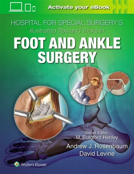Hospital for Special Surgery's Illustrated Tips and Tricks in Foot and Ankle Surgery - David Levine