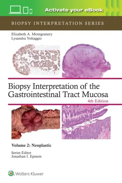 Biopsy Interpretation of the Gastrointestinal Tract Mucosa Volume 2 - ELIZABETH ANNE MONTGOMERY, LYSANDRA VOLTAGGIO