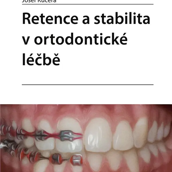 Kniha: Retence a stabilita v ortodontické léčbě od Kučera Josef