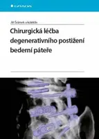 Chirurgická léčba degenerativního postižení bederní páteře - Jiří Šrámek