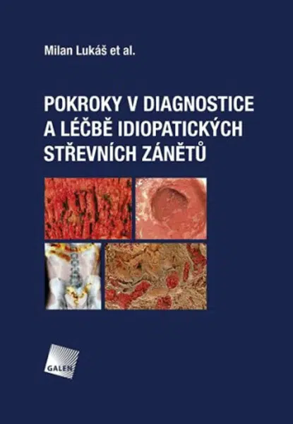 Pokroky v diagnostice a léčbě idiopatických střevních zánětů - Milan Lukáš