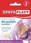 3M Spofaplast 912 Gélové náplasti na pľuzgiere na pätách