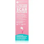 MomCare by Lina C-Section Silicone Scar Patches silikonové náplasti na jizvy po císařském řezu velikost L-XL 5 x 20 cm 3 ks