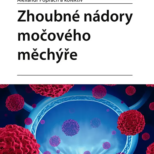 E-kniha: Zhoubné nádory močového měchýře od Poprach Alexandr