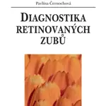 E-kniha: Diagnostika retinovaných zubů od Černochová Pavlína